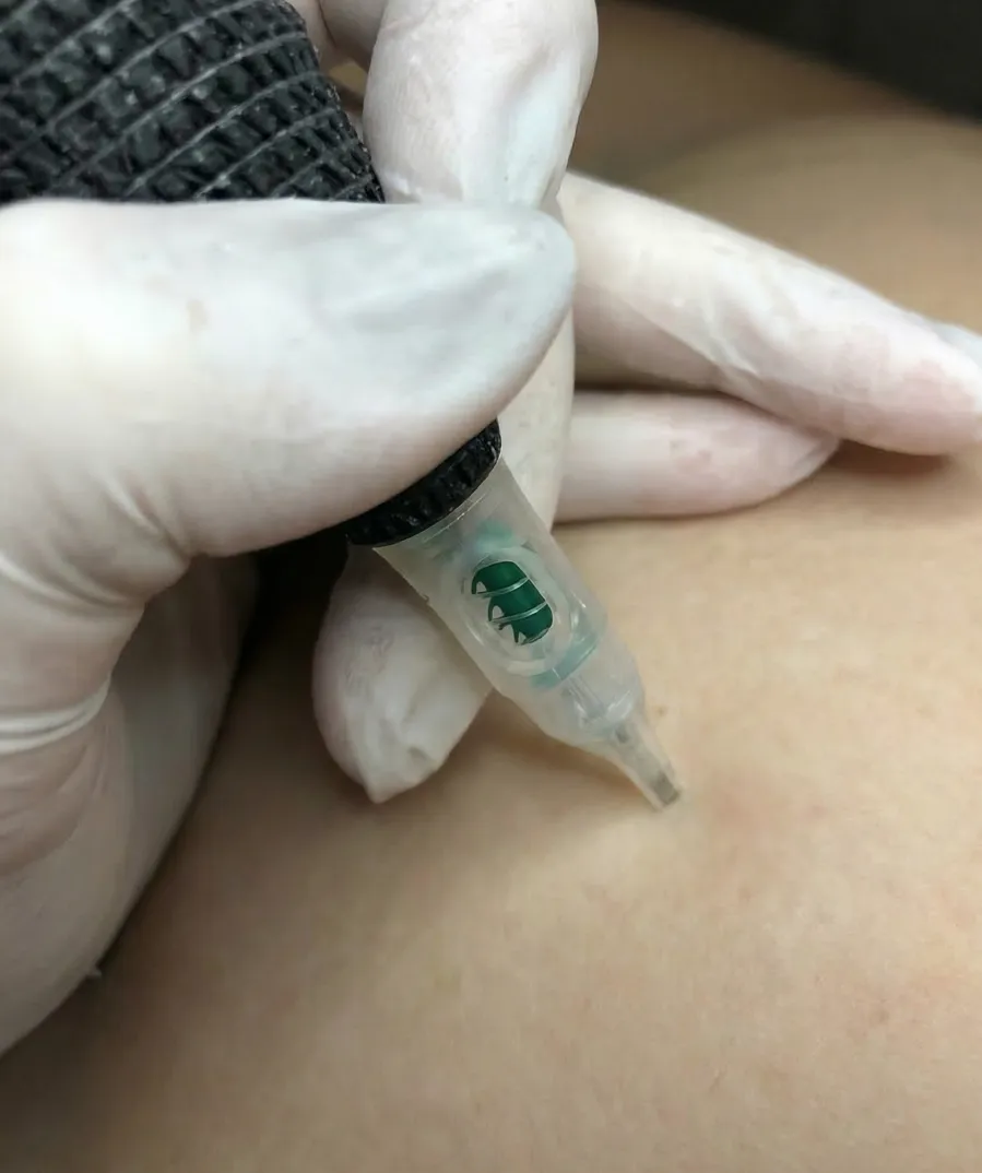 Procedimento de Tratamento em Clínica